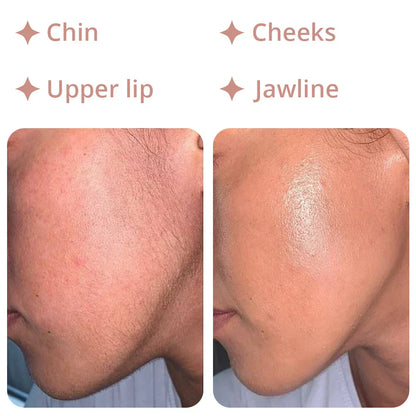 Depilador Facial 18K Pro